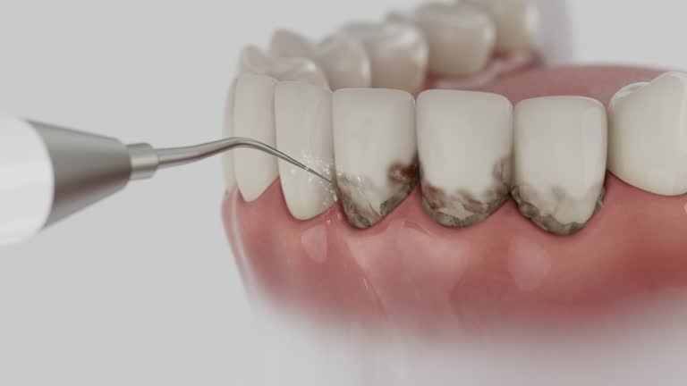 Reliable Dental Implants contractor in Washburn, IL by Smile Center Dentistry
